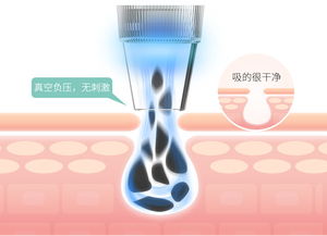 mks美克斯電動(dòng)毛孔清潔器 告別黑頭粉刺，開啟深層凈澈護(hù)膚時(shí)代